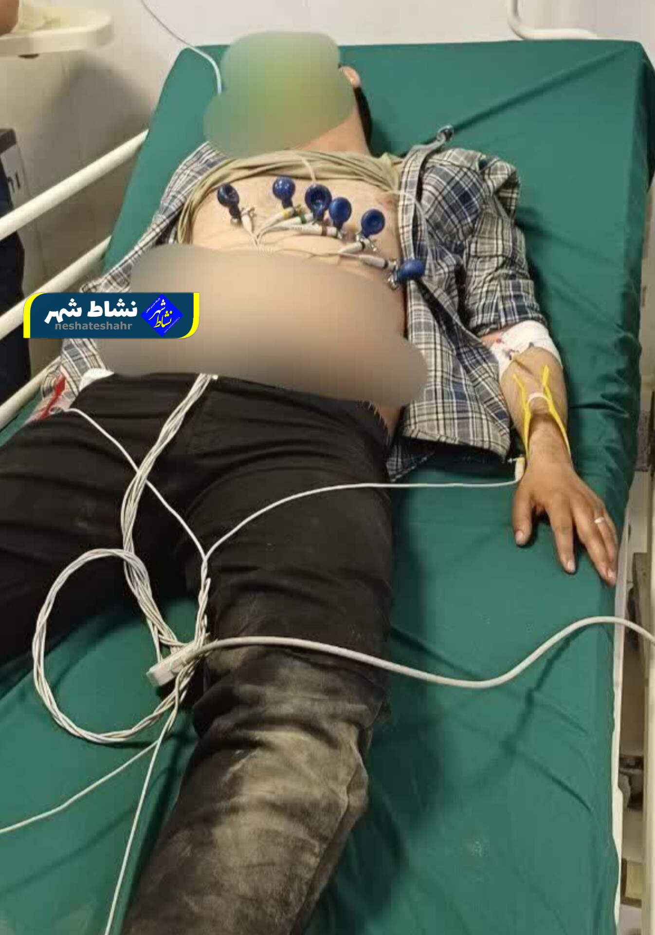 ضرب و شتم زوج جوان در همدان بر سر سگ‌گردانی